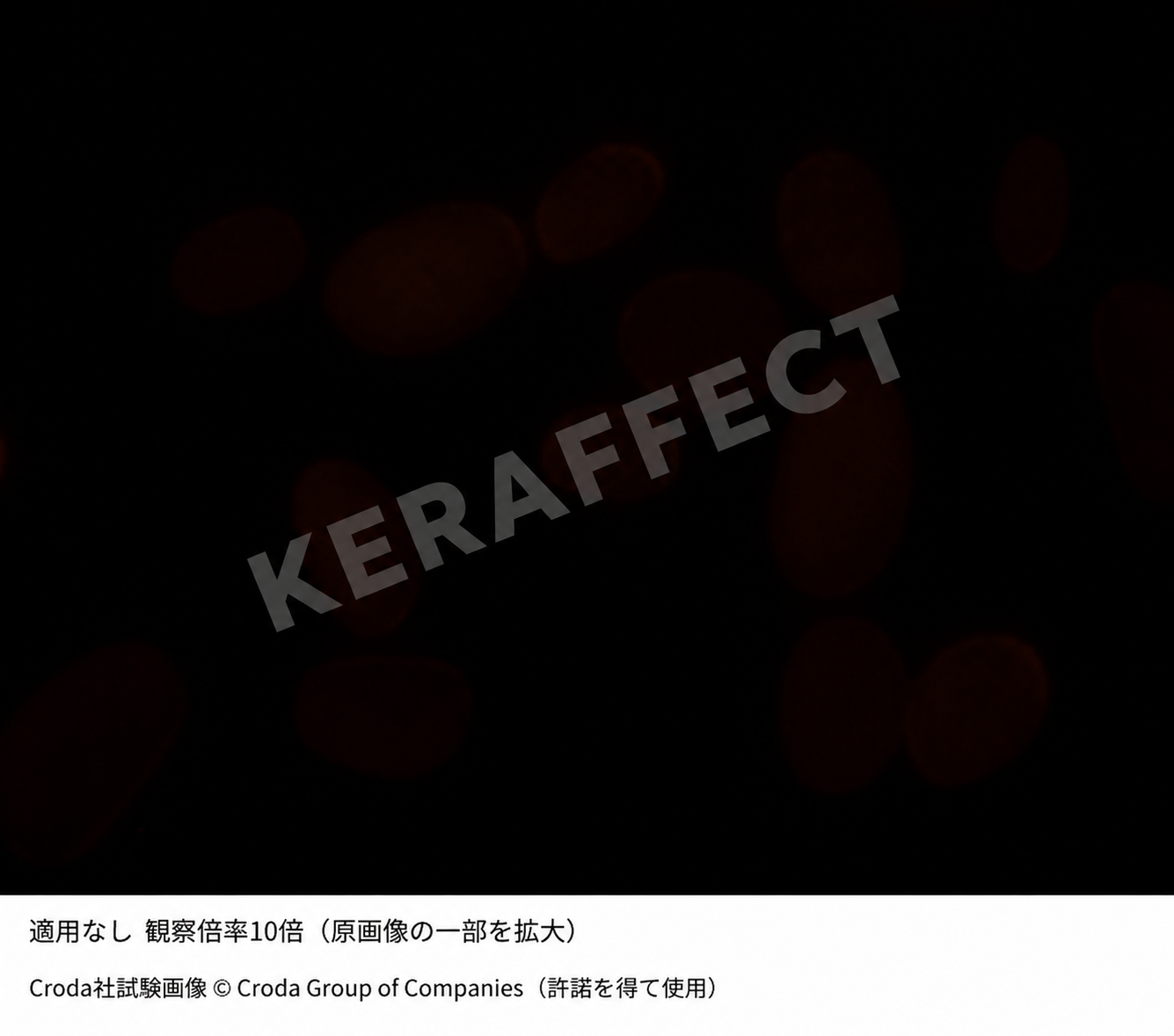 VK BOOSTER SERUM MIST 適用なし 毛髪断面 蛍光顕微鏡画像 10倍